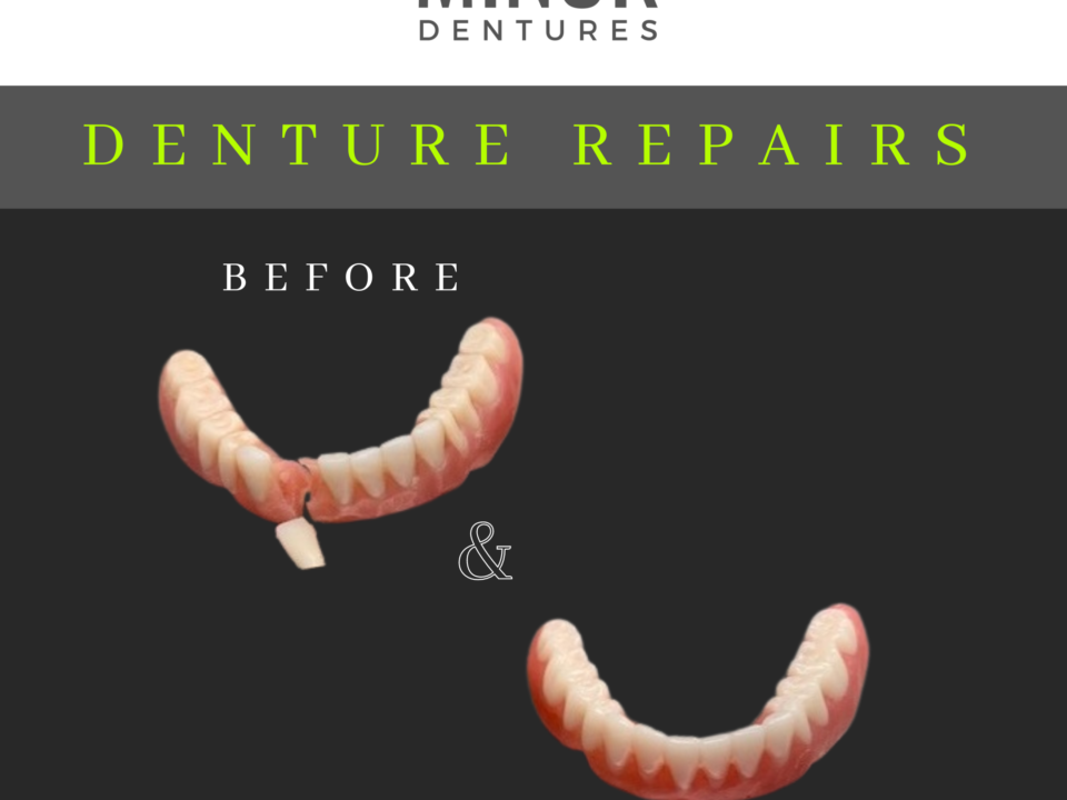 Denture Repair